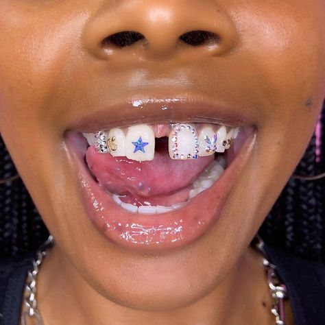 Girl Grillz, Pretty Teeth, Grillz Teeth, Tooth Gems, Loose Tooth, Gap Teeth, Grills Teeth, Tooth Gem, Teeth Jewelry