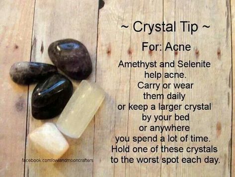 Crystals for acne - Pinned by The Mystic's Emporium on Etsy Crystal Prescriptions, Stone Meanings, Crystal Tips, Unique Crystals, Crystal Reiki, Crystal Power, Gemstone Meanings, Crystal Therapy, Crystal Healing Stones