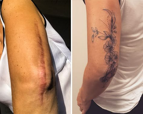 Vertical Tummy Scar Tattoo, Inner Arm Scar Tattoo Coverup, Elbow Scar Tattoo, Ankle Tattoo Scar Cover, Long Scar Tattoo, Back Lift Scar Tattoo, Knee Replacement Scar Tattoo Cover Up, Upper Arm Scar Tattoo Coverup, Long Scar Tattoo Cover Up