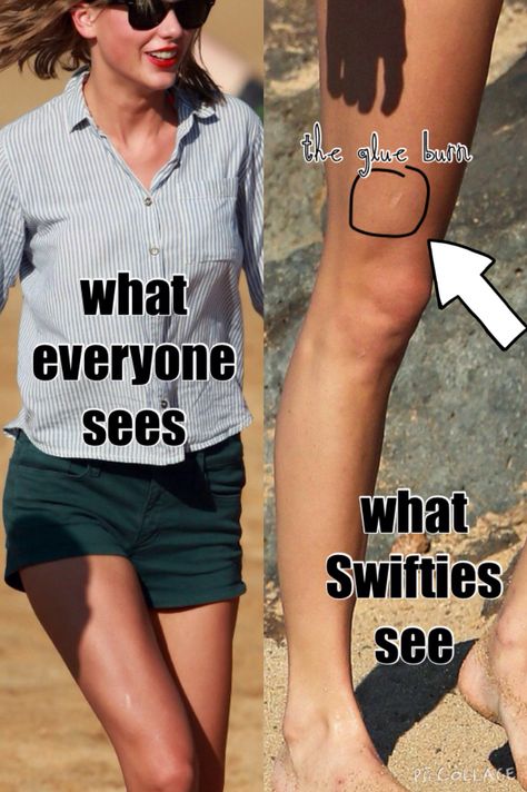 Yep, the glue gun scar from the popsicle stick castle Swift Facts, Taylor Swift Facts, Taylor Swift Funny, Are You Okay, Popsicle Stick, Celebrity Design, Red Taylor, Long Live Taylor Swift, Live Taylor