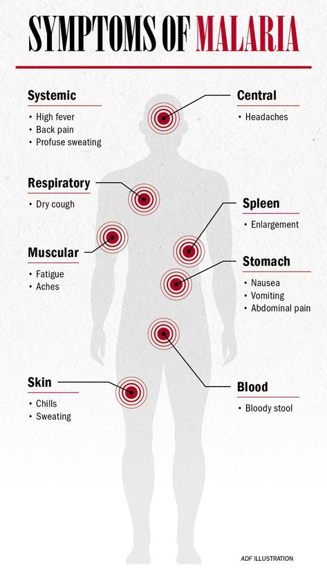 Malaria Disease, Malaria Symptoms, Physician Assistant School, Health Equipment, Nurse Study Notes, Zika Virus, Pharmacology Nursing, Disease Symptoms, Respiratory Infection