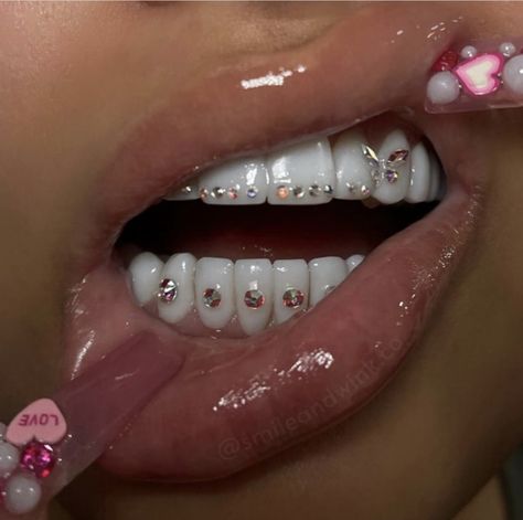 Teeth Gems, Pretty Teeth, Dental Jewelry, Grillz Teeth, Diamond Teeth, Tooth Gems, Gem Top, Grills Teeth, Tooth Gem