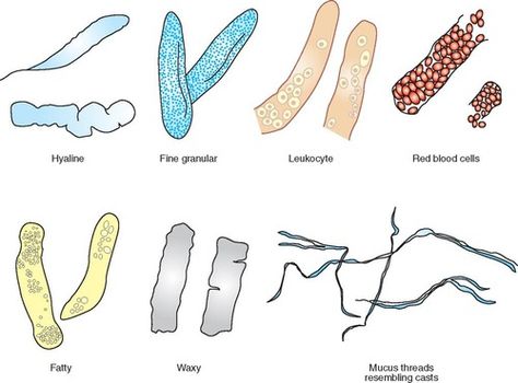 Urine Sediment Cast Flashcards | Quizlet Medical Laboratory Technician, Laboratory Technician, Vet Medicine, Medical Laboratory Science, Bookmark Craft, Body Fluid, Laboratory Science, Medical Laboratory, Nursing Study