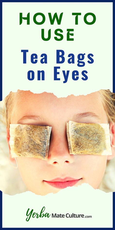 Tea Bags For Eyes Aesthetic, Chamomile Tea Bags For Eyes, Chamomile Eye Compress, Tea Bags On Eyes, Tea Bags For Eyes, Swollen Eyelids Remedy, Tired Eyes Remedy, Teabags For Eyes, Eye Bag Remedies