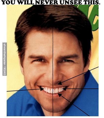 Tom Cruise has a tooth at the exact center of his face. Crap. I can't unsee it. Check google images if you don't believe me :) Tom Cruise Teeth, Dental Humor, Funny Captions, Obi Wan, Look Here, Tom Cruise, Look At You, Bones Funny, The Words