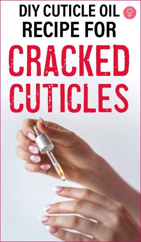 DIY Cuticle Oil Recipe for Cracked Cuticles Cuticle Oil Recipe, Cuticle Oil Diy, Dry Cracked Cuticles, Best Cuticle Oil, Cuticle Repair, Dry Cuticles, Cuticle Cream, Cuticle Care, Cuticle Remover