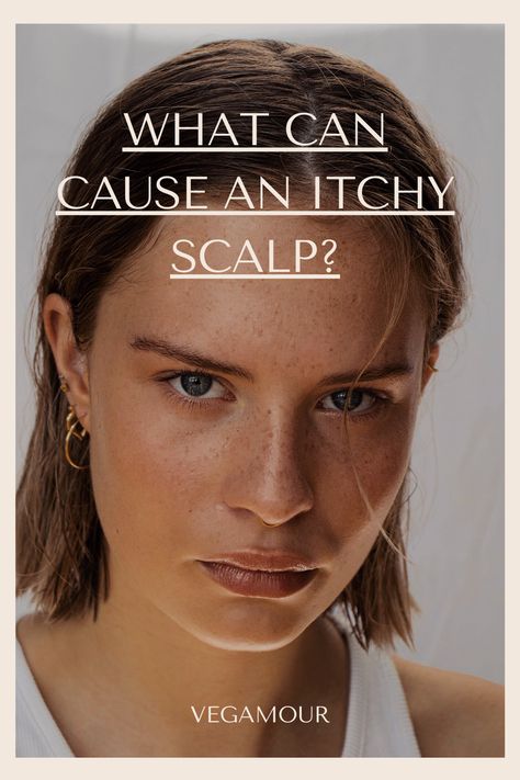 Itchy Scalp Causes, Itchy Scalp Remedy, Scalp Itch, Androgenetic Alopecia, Dry Itchy Scalp, Aging Hair, Dry Skin Remedies, Air Dry Hair, Coconut Oil Hair