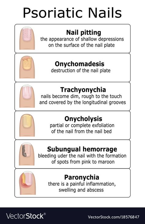 Cosmetology State Board, Beauty School Cosmetology, Nail Disorders, Nail Tech School, Nail Problems, Nail Courses, Tongue Health, Cuticle Care, Nail Care Routine