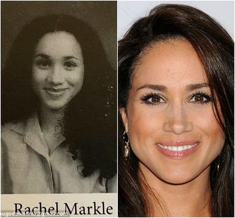 Megan Markle Nose, Meghan Markle Nose Job, Meghan Markle Plastic Surgery, Ethnic Rhinoplasty, Celebs Without Makeup, Meghan Markle Style, Celebrity Plastic Surgery, Celebrities Before And After, Lady Diana Spencer