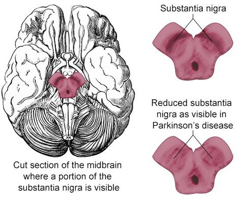 Location of Substantia nigra Med Notes, Substantia Nigra, Brain Diagram, Muscle Movement, Nursing 101, Bill Nye, Biology Notes, Circadian Rhythm, Anatomy And Physiology