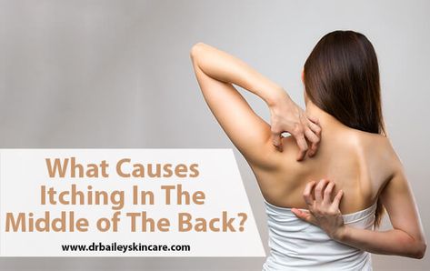 10% of people will develop an intense itch in the middle of their back over their lifetime! Many of my patients have an itchy back and it makes them crazy. Typically I can see the spot where there is a darkening of the skin indicating that they have reached back and scratched there for years. … Scale Skin, Itchy Rash, Cynthia Bailey, Flaking Skin, Itching Skin, Anti Itch Cream, Advanced Skin Care, Scaly Skin, Skin Brushing