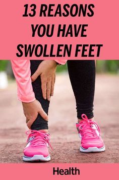 Whether the swelling is slight or your feet feel like balloons, something's off—and anything from changes in your weight to hormone weirdness to a serious condition like heart disease could be to blame. Our guide will help you decode what's going on, and what you can do to fit into your shoes again. Swelling Remedies, Ankle Swelling, Swollen Feet Remedies, Water Retention Remedies, Feet Remedies, Leg Circulation, Tomato Nutrition, Calendula Benefits, Zinc Deficiency