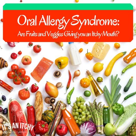 Oral Allergy Syndrome: Are Fruits and Veggies Giving you an Itchy Mouth? Oral Allergy Syndrome Chart, Oral Allergy Syndrome Recipes, Lvn School, Vegetable Pizza Recipes, Save On Foods, Eat Veggies, Pollen Allergies, Pizza Recipes Homemade, Cooked Apples