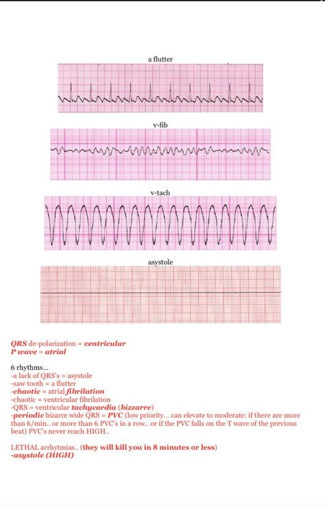 NCLEX RN Study Guide Cram Sheet - Payhip Nclex Next Gen Study Plan, Acls Study Guide 2022, Wound Healing Nursing, Nclex Study Guide Cheat Sheets, Ecg Reading, Acls Study Guide, Nclex Notes, Mark Klimek, Nursing School Studying Cheat Sheets