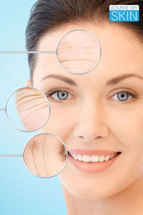 What Is the Best Form of Vitamin C in Skin Care? Best Homemade Face Mask, Benefits Of Sleeping, Dark Circles Makeup, Unhealthy Habits, Face Scrub Homemade, Face Wrinkles, Anti Aging Moisturizer, Homemade Face Masks, Homemade Face