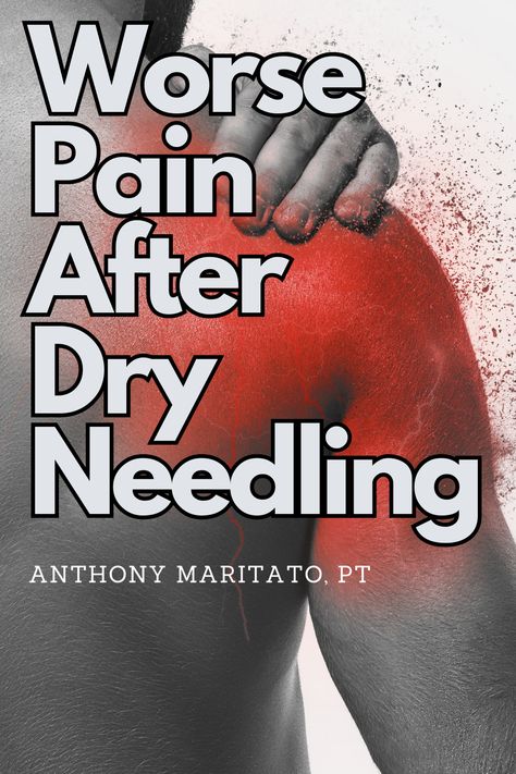 Man with shoulder pain that is worse after dry needling. Dry Needling Benefits, Dry Needling Trigger Points, Dry Needling Therapy, Dry Needling, Trigger Points, Back Pain