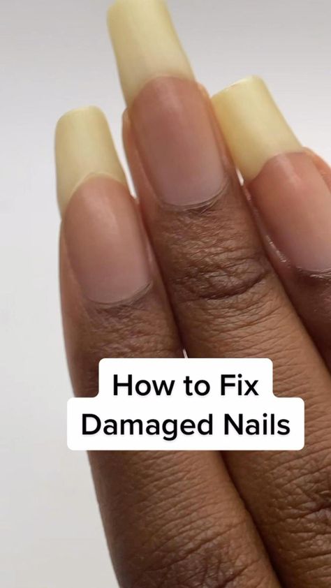 Grow Long Nails, Nail Growth Tips, Grow Nails Faster, Damaged Nails, Nail Care Tips, Nail Care Routine, How To Grow Nails, Nail Oil, Brittle Nails