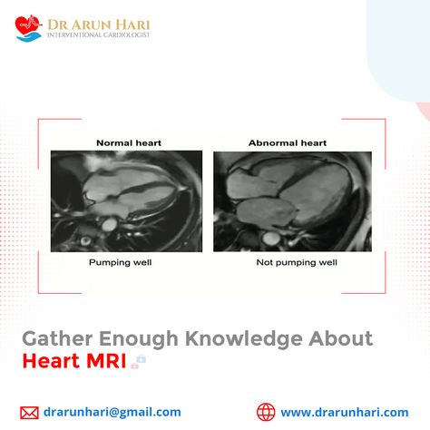 Heart MRI, also known as cardiac MRI, is a non-invasive medical imaging technique that uses a magnetic field and radio waves to produce detailed images of the heart. What more? Read our article to know more. You can approach Dr Arun Hari through his website https://drarunhari.com/book-appointment/ Normal Heart, Radio Waves, Heart Pump, Book Appointment, About Heart, Radio Wave, Medical Imaging, Magnetic Field, Cardiology