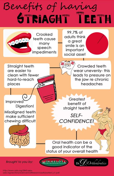 Benefits of Having Straight Teeth Straight Teeth, Headache, Braces, Benefits, Quick Saves