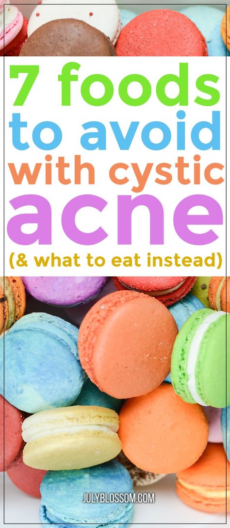 7 Foods to Avoid with Cystic Acne - ♡ July Blossom ♡ Food For Acne, Cystic Acne Remedies, Acne Diet, Inflammation Diet, Witch Herbs, Acne Free Skin, Diy Acne, Acne Skincare Routine, Natural Acne Remedies