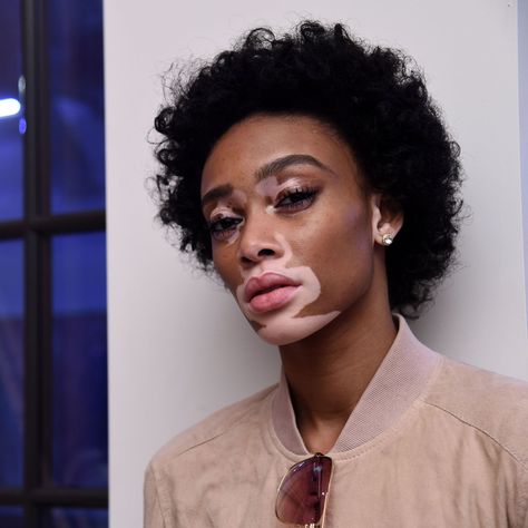 Winnie Harlow, inspiring, natural beauty, different, sensual Chantelle Brown Young, Glamour Beauty, Thick Skin, Winnie Harlow, Vogue Beauty, Makes You Beautiful, Body Inspiration, Beauty Queens, Trendy Hairstyles