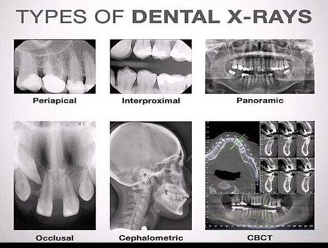 Dental Assistant Study Guide, Dental Assistant School, Dental Hygienist School, Dental Assistant Study, Dental Hygiene Student, Kedokteran Gigi, Dental Hygiene School, Dentistry Student, Dental Anatomy