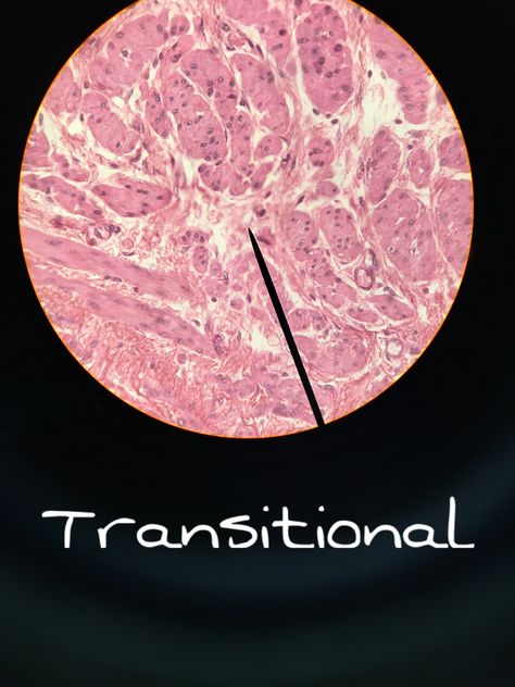 Transitional epithelium Transitional Epithelium, Epithelial Tissue, Histology Slides, Medical Laboratory Science, Human Anatomy And Physiology, Medical Laboratory, Laboratory Science, Med Student, Anatomy And Physiology