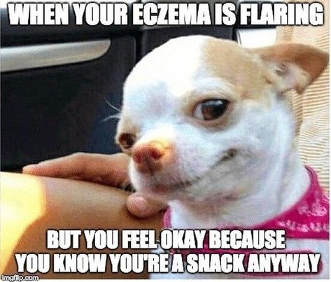 @oureczemastory posted to Instagram: When your eczema is flaring but you feel okay because you know you’ are snack anyway#oureczemastory #eczemarelie#eczema #eczemacare #eczemasolution #eczemaawarenessmonth #eczemababie #eczemabattle #Eczemas #eczemakids #eczemarecovery #eczemamalaysia #eczemaholistichealing #eczemasupport #eczemawarrior #eczemabalm #eczemaempowerment #eczemafriendly #eczemadiet #eczemawarriors Fat Chihuahua, Chihuahua