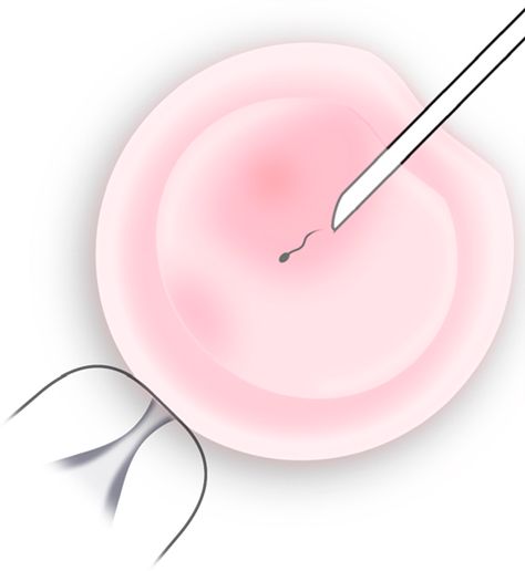 Fertility Problems, Ivf Success, Fertility Center, In Vitro Fertilization, In Vitro, An Egg, The Egg, Primary School, Fertility