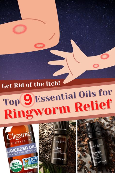 illustration of ringworm on arms and pictures of essential oils Ring Worm Essential Oils, Aloe Vera For Sunburn, Remedies For Dry Mouth, Home Remedies For Allergies, Home Remedies For Warts, Oily Skin Remedy, Warts Remedy, Top Essential Oils, Natural Remedies For Migraines