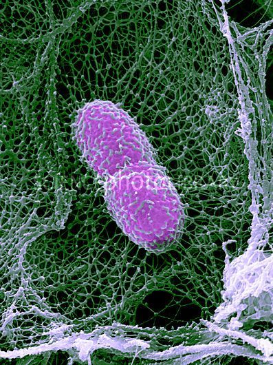 Klebsiella pneumoniae bacterium. Coloured scanning electron micrograph (SEM) of a Klebsiella pneumoniae bacterium in a mouse lung. It is caught in a neutrophil extracellular trap (NET, green), a web of extruded chromatin that contains antimicrobial components that kill the bacterium. Neutrophils are the most abundant cell of the immune system. Klebsiella pneumonia is a Gram-negative, rod-shaped (bacillus) bacterium that is part of the normal flora of the skin and intestines. However, in those w Klebsiella Pneumoniae, Scanning Electron Micrograph, Microscopic Photography, Microscopic Images, Electron Microscope, Extreme Close Up, Science Photos, Green A, Urinary Tract