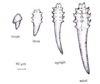 Can you feel hard Demodex mite eggs under the skin? | Ungex Demodex Mites, Human Mouth, Skin Parasites, Microscopic Photography, Under The Skin, Hair Issues, Dog Skin, Medical Knowledge, In The Darkness