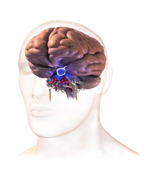 Pituitary Gland Tumor, Pituitary Tumor, Ms Disease, Cushings Syndrome, Spinal Fluid, Facial Nerve, Addisons Disease, Adrenal Health, Peripheral Nerve