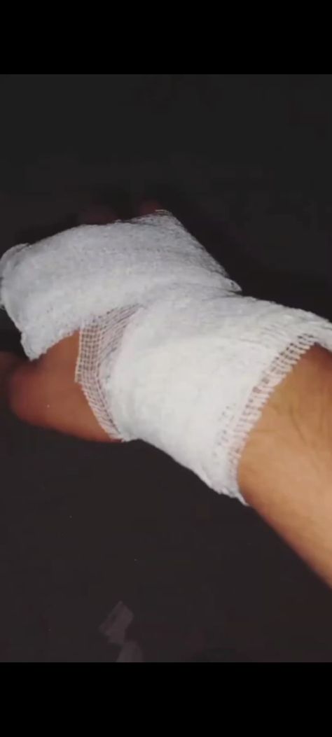 Injury Photoshoot, Hand Fracture Pics With Plaster, Bandaging Hands Aesthetic, Hand Dressing Photo Hospital, Leg Accident Real Pic In Hospital, Bandage Hands Snapchat, Accident Boys Dpz Hospital, Fake Hospitalized Snaps Hand, Bandage On Hand Photo