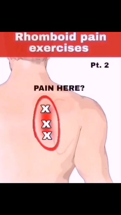 Shoulder Rehab Exercises, Neck Pain Exercises, Shoulder Pain Exercises, Neck And Shoulder Exercises, Body Massage Techniques, Yoga Facts, Sciatica Exercises, Neck Exercises, Physical Therapy Exercises