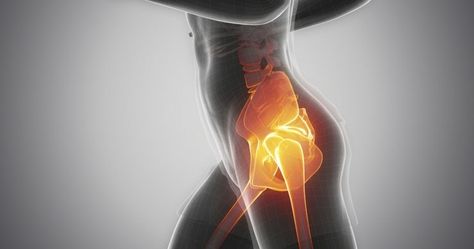 Hip Labral Tear Recovery Without Surgery | Centeno-Schultz Clinic Hip Labral Tear, Torn Labrum, Hip Dislocation, Iliotibial Band, Lumbar Disc, Hip Problems, Nerve Health, Spinal Nerve, Platelet Rich Plasma