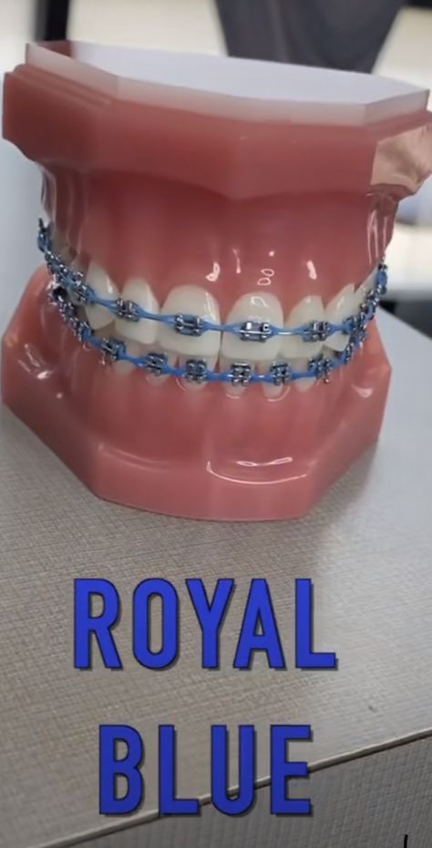 Dark Blue Braces, Light Blue Braces, Power Chain Braces, Dental Braces Colors, Braces Colors Combinations, Pink Braces, Green Braces, Braces Colors Ideas, Jewelry Teeth