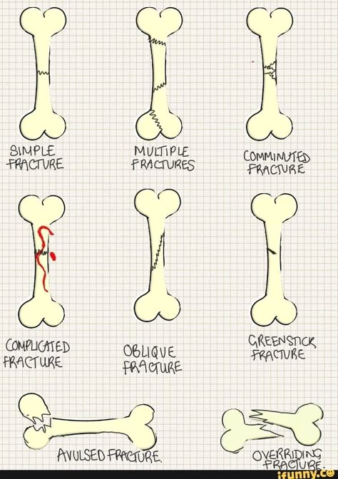 Body Planes, Vet Tech School, Vet Tech Student, Studera Motivation, Cardiovascular Disorders, Vet Medicine, Nurse Study Notes, Nursing Student Tips, Vet Assistant