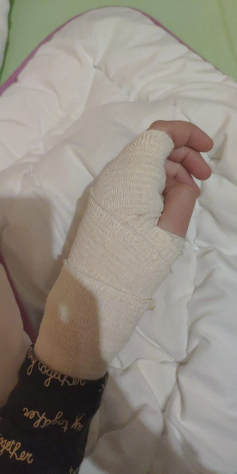 Hand With Bandage, Burned Hand Pic, Lockscreen Iphone Quotes, Fake Injury, Hospital Room Snapchat Stories, Sisters Photoshoot Poses, Hospital Admit Hand Pics, Camera Tattoo, Leg Injury