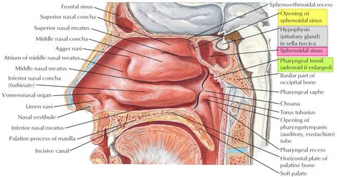 Learn about sphenoid sinus anatomy and its function. What are causes sphenoid sinus infection and how sinus infection treated. Sphenoid sinus surgery Sinus Anatomy, Palatine Bone, Acute Sinusitis, Paranasal Sinuses, Maxillary Sinus, Internal Carotid Artery, Sinus Cavities, Chronic Sinusitis, Soft Palate