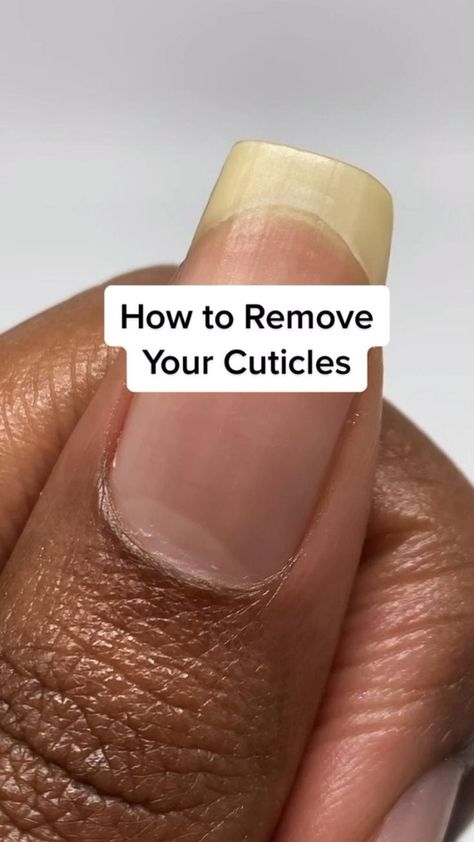 Fingernail fungus from acrylic nails How To Remove Cuticles, Clean Cuticles, Cleaning Nails, Short Nails Natural, Manicure Ideas For Short Nails, Nail Growth Tips, Fingernail Fungus, Ideas For Short Nails, Remove Acrylic Nails