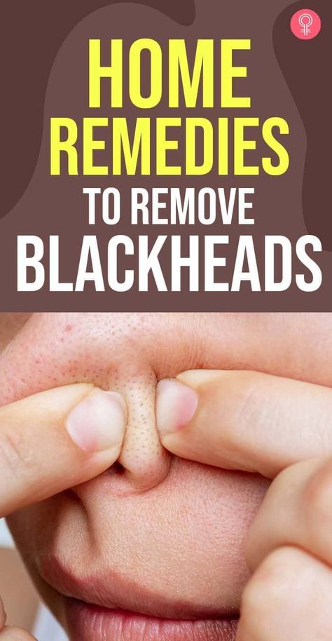 Best Cough Remedy, How To Remove Blackheads, Blackhead Remedies, To Remove Blackheads, Blackheads On Nose, Remove Blackheads, Natural Sleep Remedies, Natural Health Care, Natural Cold Remedies