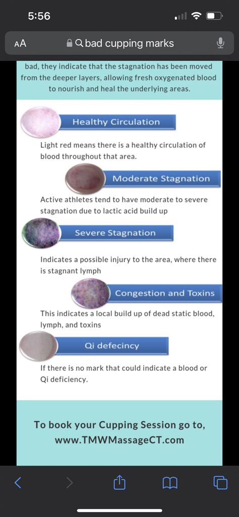 Cupping Therapy Placement Chart, Cupping Placement Chart, Cupping Therapy Chart, Suction Cup Therapy, Cupping Points, Parlor Ideas, Benefits Of Cupping, Massage Studio, Cupping Massage