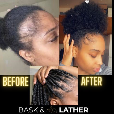 Jumbo Scalp Stimulator | Hair Growth Stimulator | Bask and Lather Co Scalp Stimulator, Alopecia Hairstyles, Hair Growth Women, Natural Hair Growth Oil, Rapid Hair Growth, Growing Healthy Hair, Beach Curls, Burger Seasoning, Hair Elixir