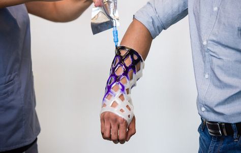 Revolutionary New Arm Cast is Waterproof, Breathable, and Itch-Free Wrist Cast Aesthetic, Ankle Fracture Recovery, Cast Covers Arm, Sprained Wrist, Ych Base, Ankle Fracture, Arm Cast, Cast Covers, Health Wealth And Happiness