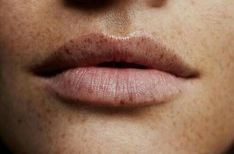 The Weeknd- Party Monster #natural #lips #freckles #beauty #details #photography #features #outdoors #random #tagforlikes Lego Poster, Fashion Gone Rouge, Piper Mclean, Yennefer Of Vengerberg, Glow Skin, Leo Valdez, Intj, Dragon Age, Beauty Photography