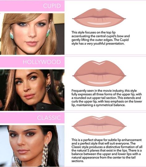 Type Of Lips, Types Of Lips Shape, Types Of Lips, Build Business, Facial Aesthetics, Lip Filler, Lip Enhancement, Botox Fillers, Lip Shapes