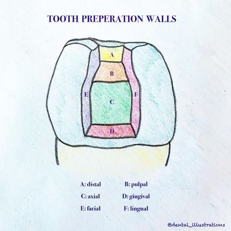 Dental IQ on Instagram: “Tooth preparation walls: . . Internal wall: a wall that does not extend to the external tooth surface: . 1. Pulpal wall: internal wall…” Dental Abbreviations, Teeth Surfaces, Dentist Aesthetic, Dentist Career, Tooth Surfaces, Hygiene Essentials, Hygiene School, Dental Assistant Study, Dentist Assistant