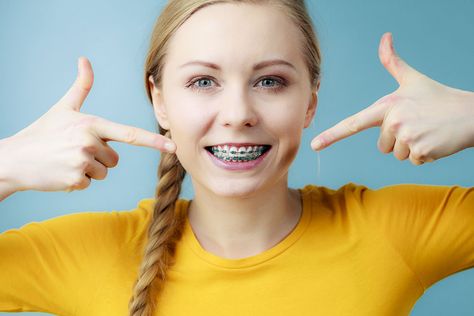 Light Blue Braces, Blue Braces, Braces Color Wheel, Orthodontics Teeth, Braces Cost, Braces Tips, Getting Braces, Dental Aesthetics, Clear Braces