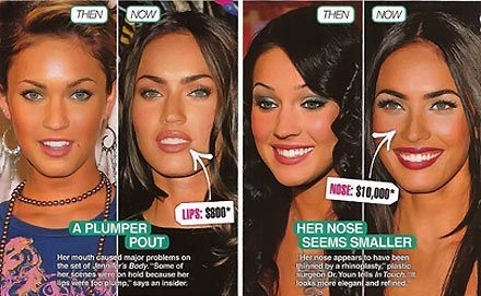 Megan Fox Megan Fox Before Surgery, Megan Fox Surgery, Megan Fox, Plastic Surgery, Surgery, Fox, Photoshop